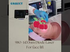 علاج شامل بالليزر الداخلي وشد الوجه الداخلي